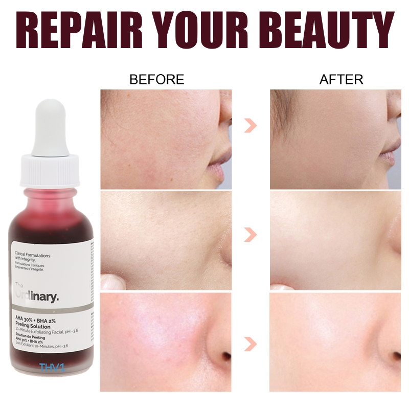 Skin Blemish Removing Serum